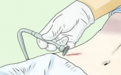 南京哪家医院看疤痕好