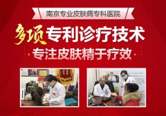 常州市看牛皮癣哪个医院好